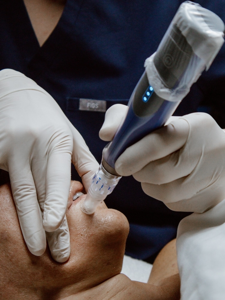 Exo Booster Microneedling behandeling bij Huidinstituut Tjeerdsma